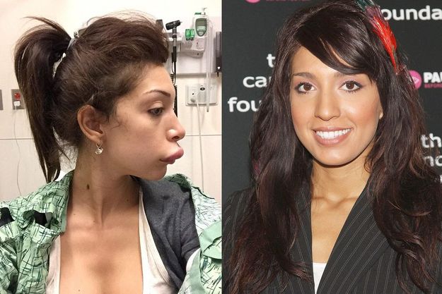 Фаррах Абрахам стала жертвой пластической хирургии