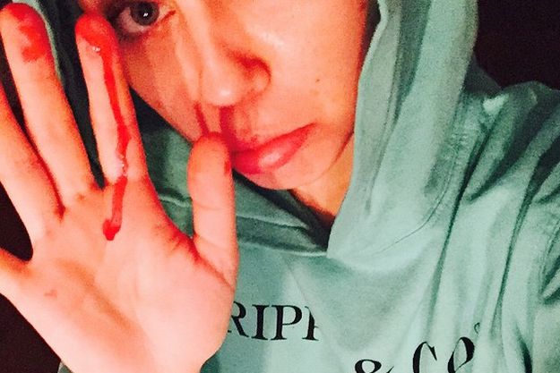 Майли Сайрус показала кровавое селфи