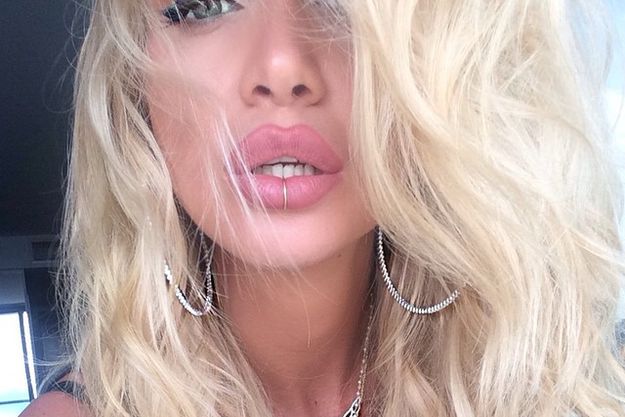 Солнце помогло Виктории Лопыревой в два раза увеличить губы