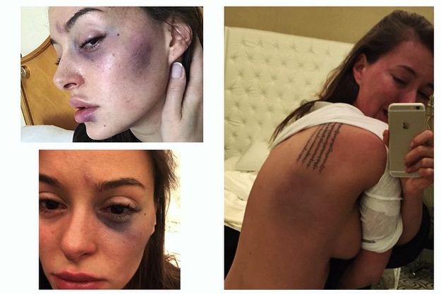 Ведущего Александра Белова обвиняют в побоях модели