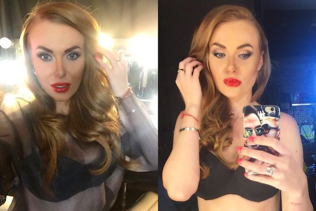 Муж лишил Славу из «НеАнгелов» груди