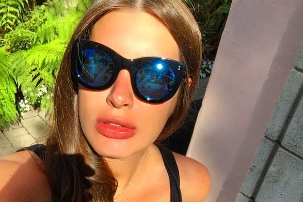 У беременной Кэти Топурии увеличились губы