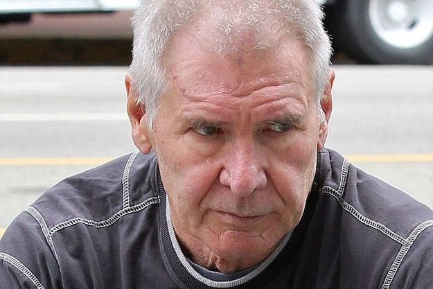 Лоб Харрисона Форда украшает огромный шрам