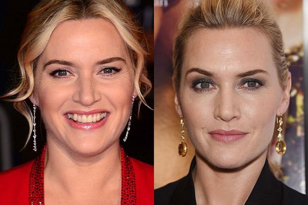Кейт Уинслет удивила помолодевшим лицом