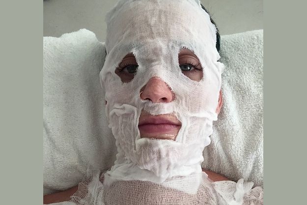 Кэти Перри шокировала фанатов своим лицом