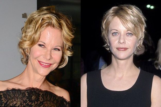 Мэг Райан пополнила ряды жертв пластической хирургии