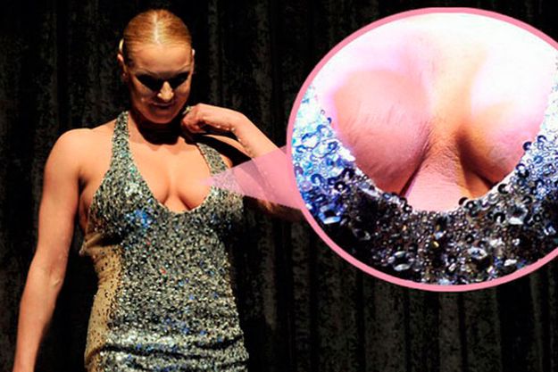 Мошенники дорисовали растяжки на груди Анастасии Волочковой