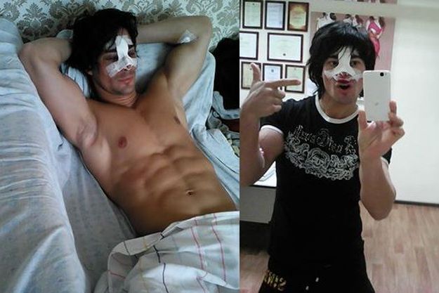 Солисту группы «На-На» во время концерта сломали нос