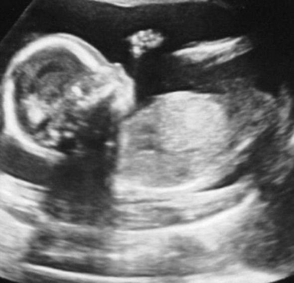 Гвен Стефани